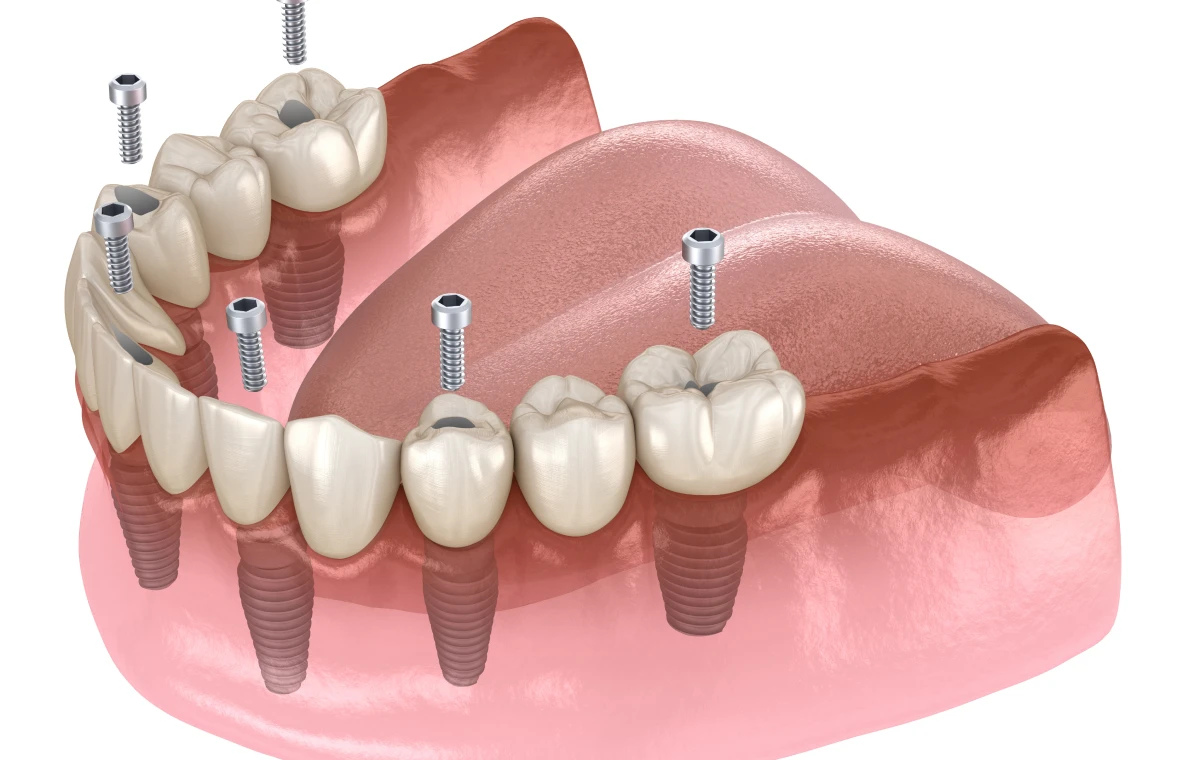 adobestock-329530989